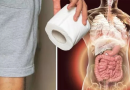 Semne timpurii ale cancerului de colon pe care nu trebuie să le ignori niciodată; îți pot salva viața